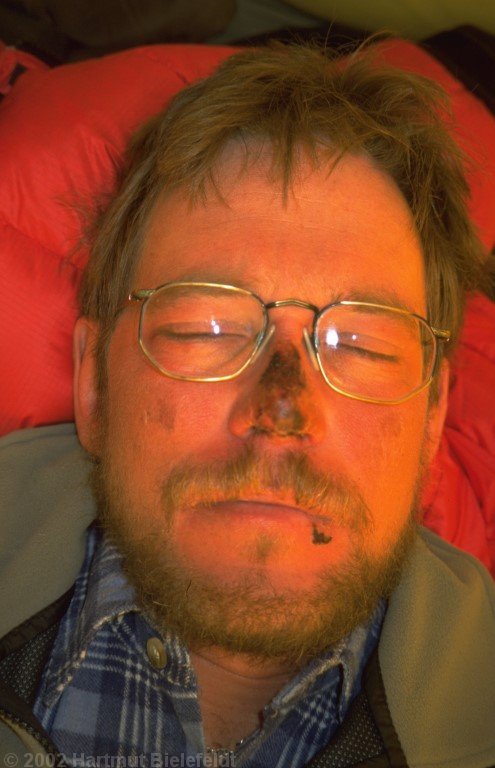 Auch die Nase hat Erfrierungen abbekommen.